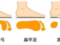 【義診預(yù)告】千里之行，始于“足”下，扁平足免費篩查來了